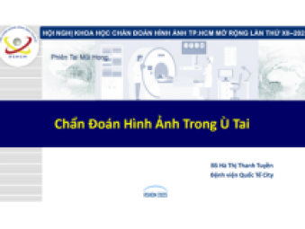 BS Hà Thị Thanh Tuyền - Chẩn đoán hình ảnh trong ù tai